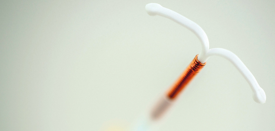 تعبیه IUD