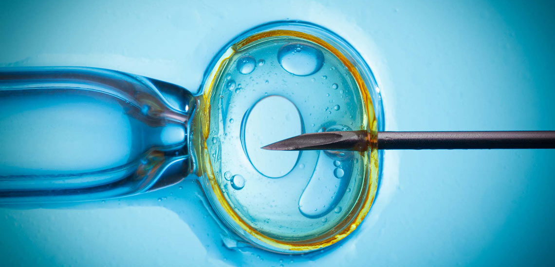 لقاح مصنوعی در آزمایشگاه یا IVF